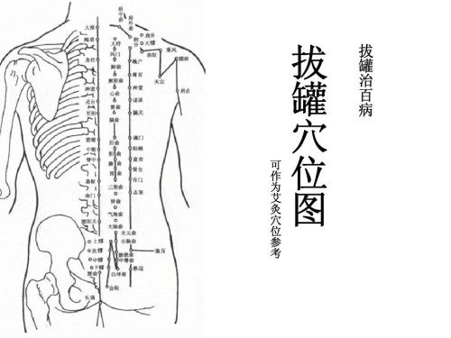 昨天拔了个火罐，简单了解了一下！