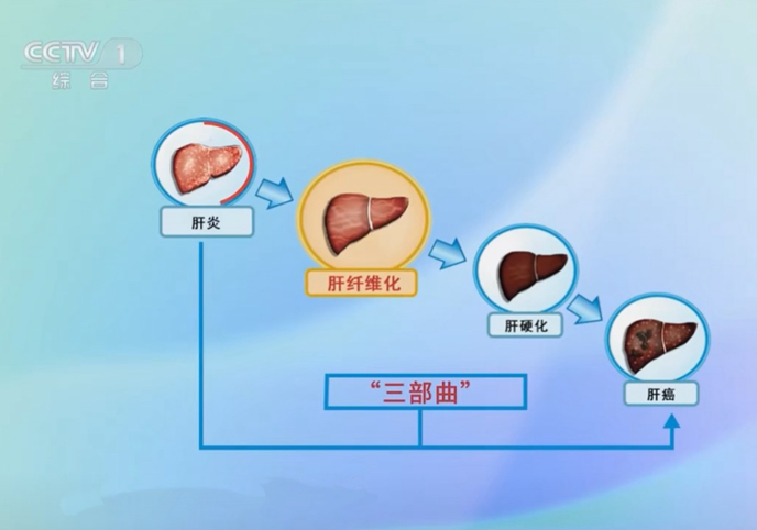 全国爱肝日：出现这些症状，是肝脏在向你“呼救”