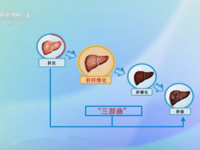全国爱肝日：出现这些症状，是肝脏在向你“呼救”